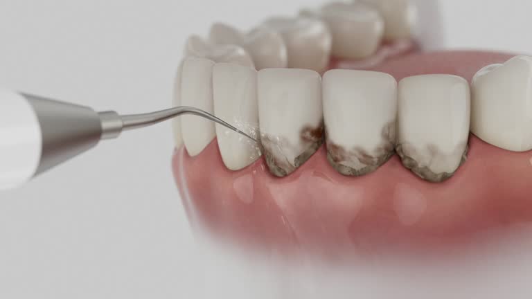 Trusted Teeth Cleaning And Checkup service in Waite Park, MN - Dentist Open Now